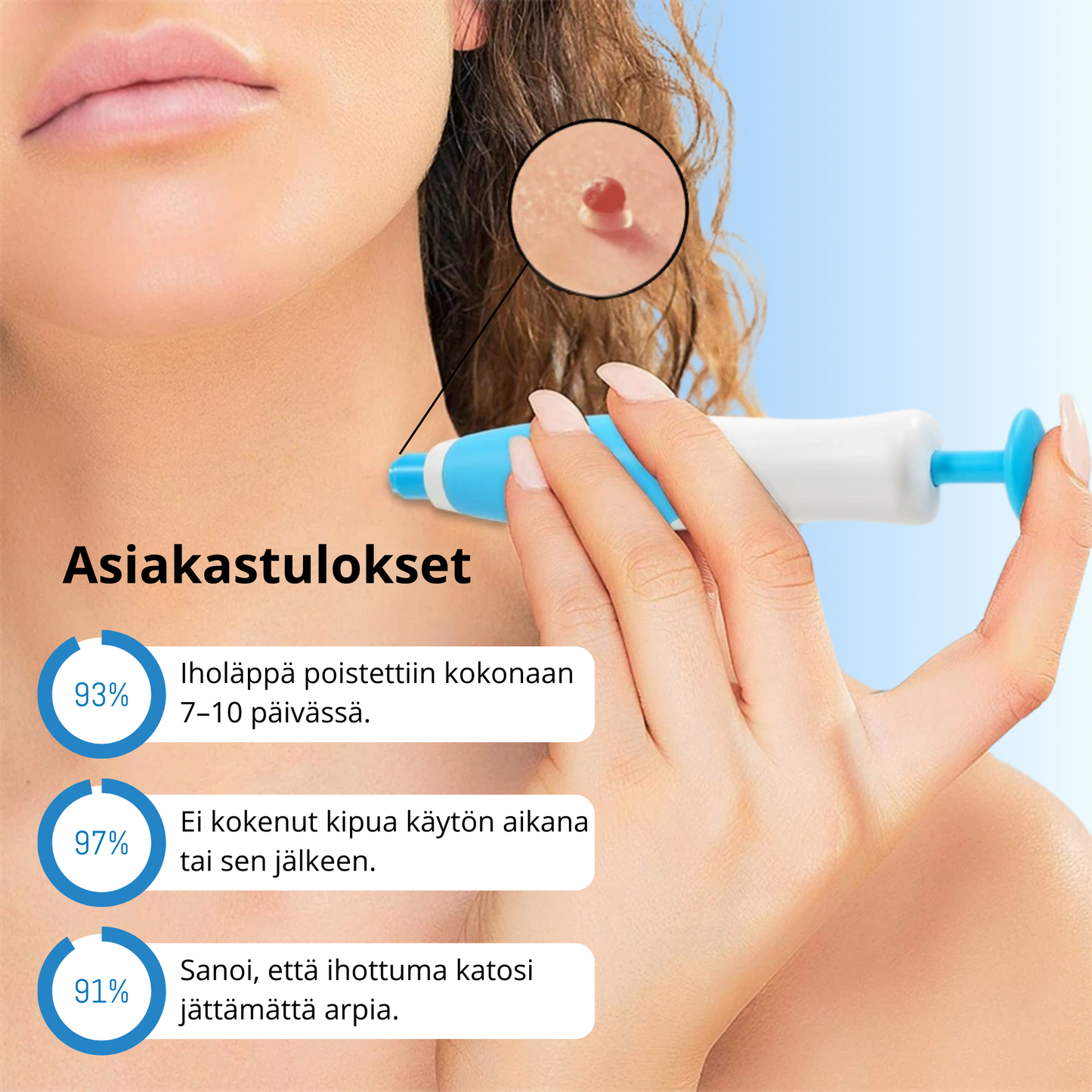DermaTag™ – Kivuton iholäpän poisto