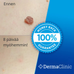 DermaTag™ – Kivuton varsiluomen poisto – DermaClinic